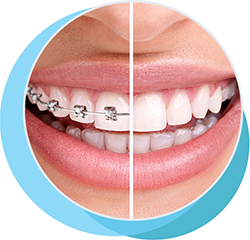 طب الأسنان التعويضي