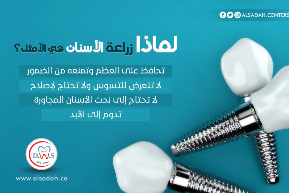 مركز السادة لطب الأسنان